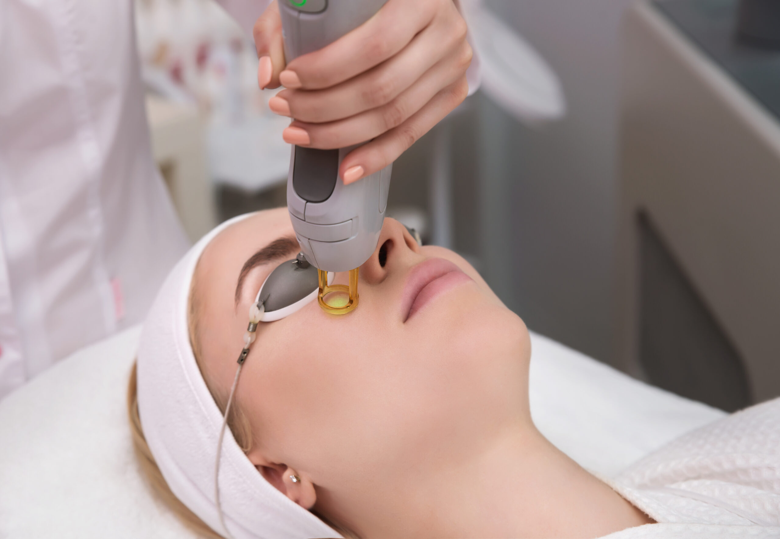Photorejuvenation treatments for acne with vascular laser
